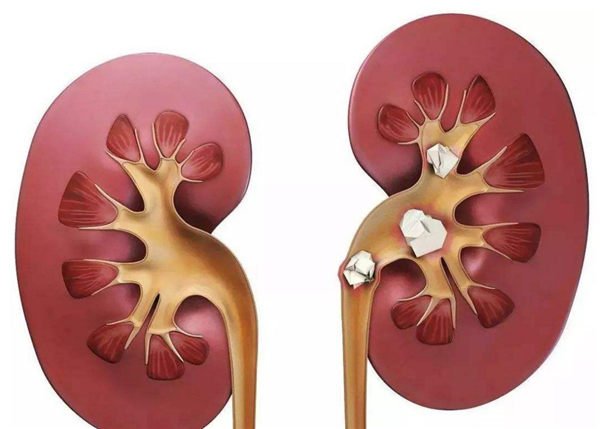橘子吃多了会怎样,不仅会上火还可能中毒